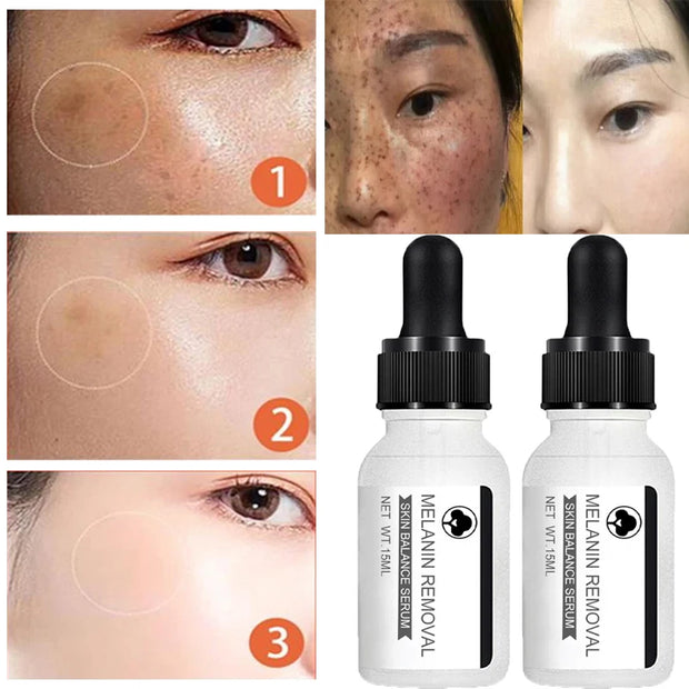 Niacinamide Whitening Serum Remove Dark Spots Freckle Essence Anti-Ag